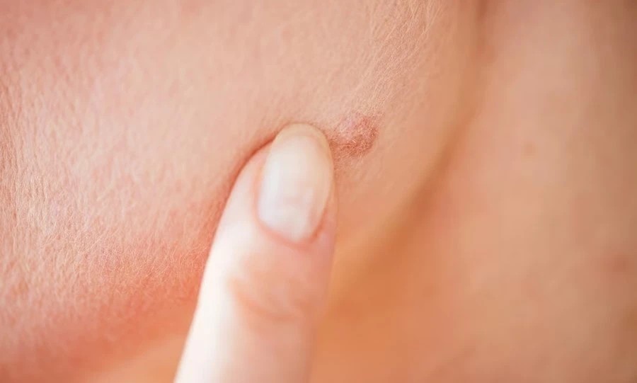 Що означають родимки на обличчі: повне тлумачення за розташуванням, культурами та наукою