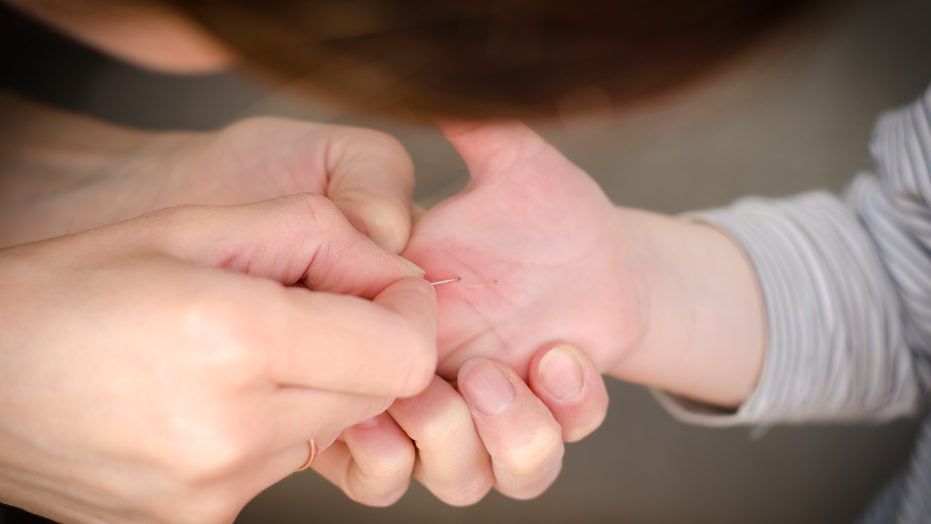 Як витягнути занозу: повний посібник без болю та ускладнень
